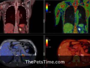 If pet scan is positive can it be anything but cancer