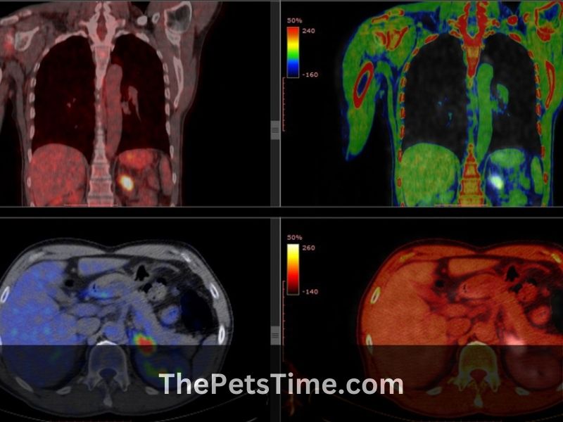 If pet scan is positive can it be anything but cancer